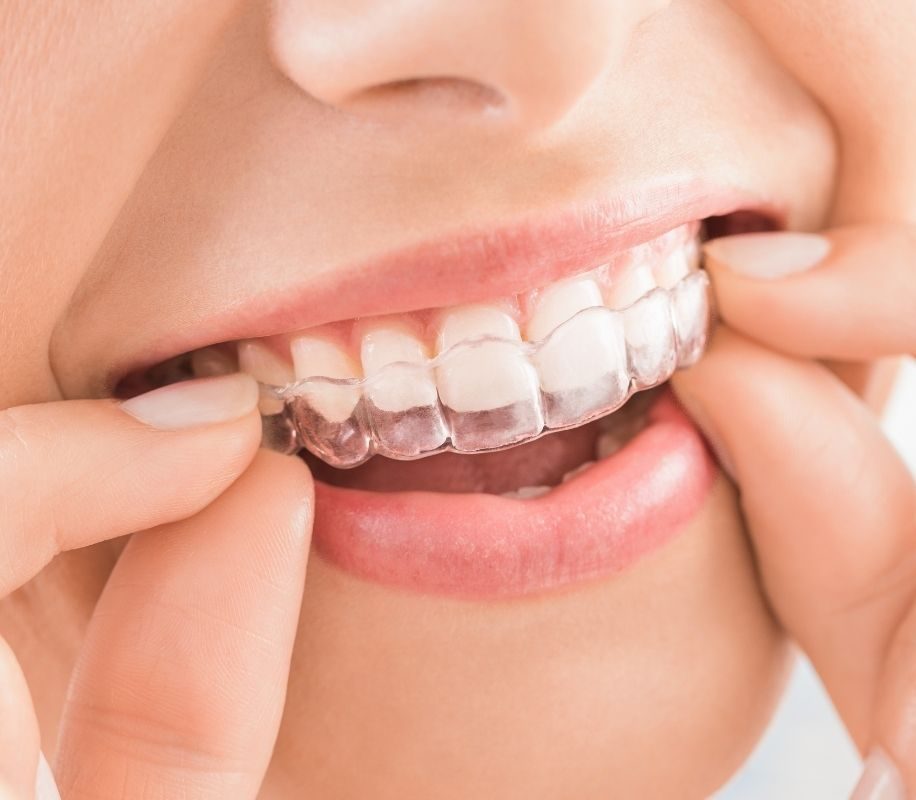 Clinica Invisalign en Santander