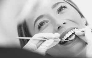 Lee más sobre el artículo Limpieza dental en Santander